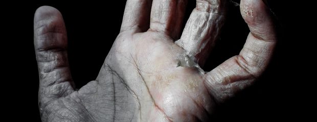 crooked dry hand palm facing