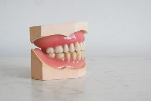 model of teeth with very red lips